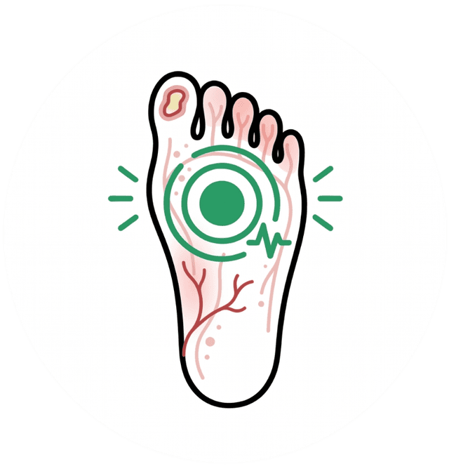 Diabetic foot