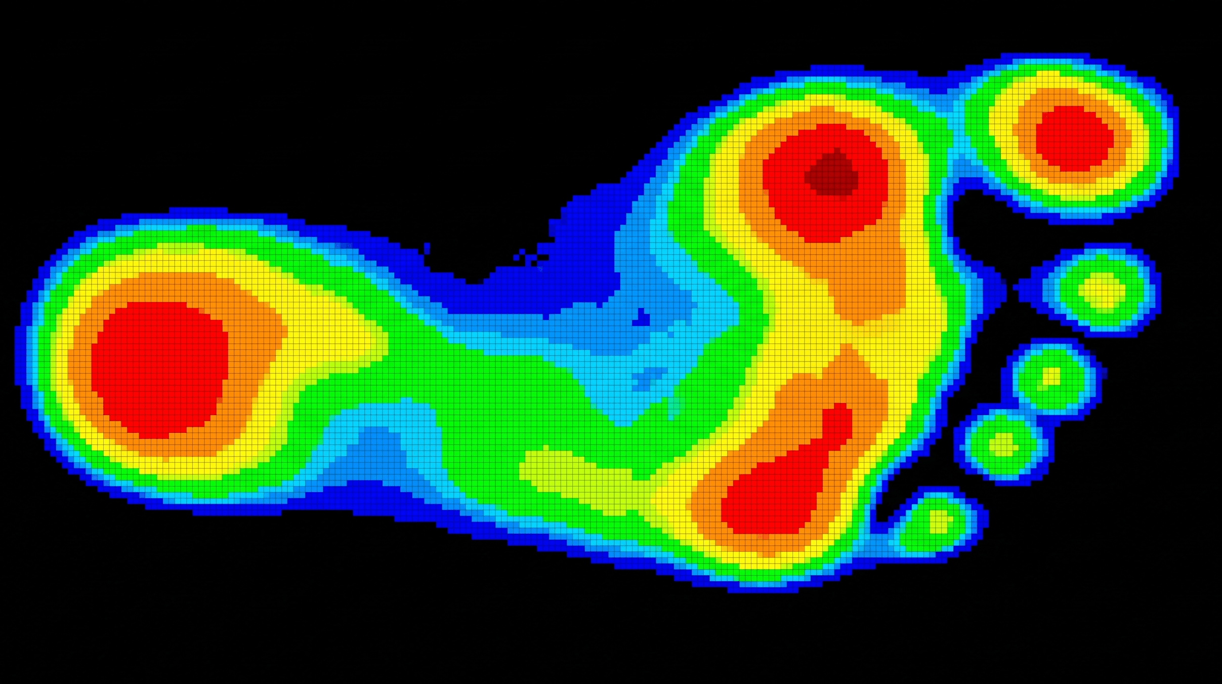 Digital heat map showing dynamic pressure distribution across a foot